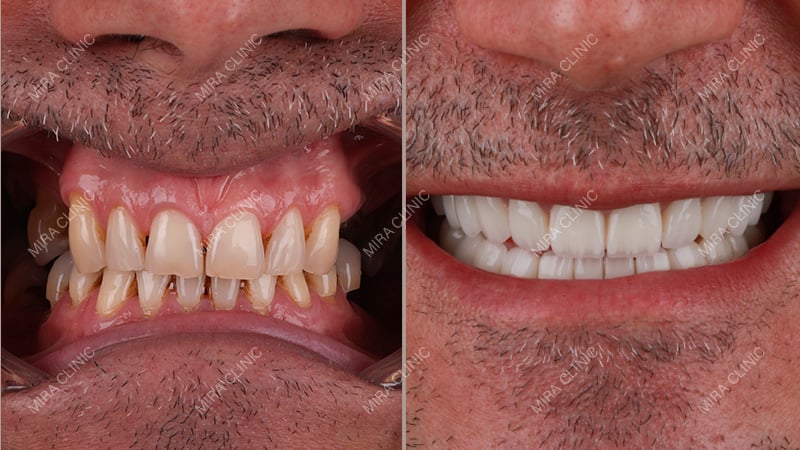before-and-after photos